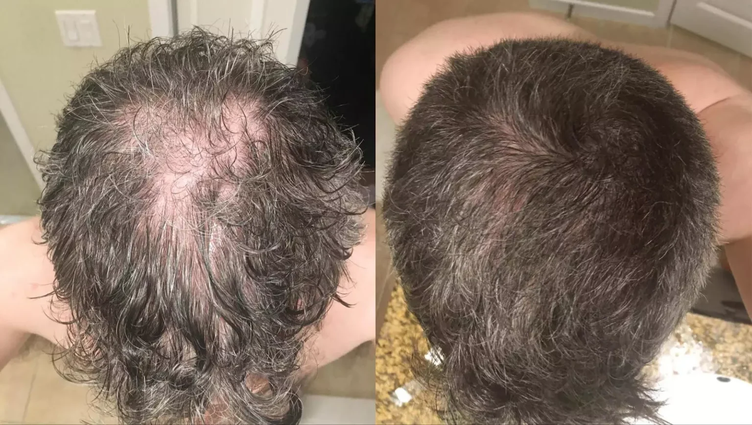 Ikaria Lean Belly Juice restolin before after results